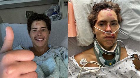 What is the status of his injuries following the. . Caleb coffee accident